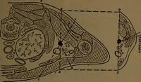 An illustration from X-ray manual : U.S. Army (1917)