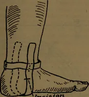 An illustration from X-ray manual : U.S. Army (1917)