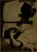 An illustration from X-ray manual : U.S. Army (1917)