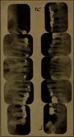 An illustration from X-ray manual : U.S. Army (1917)