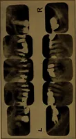 An illustration from X-ray manual : U.S. Army (1917)