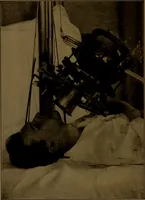 An illustration from X-ray manual : U.S. Army (1917)