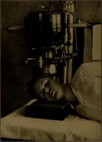 An illustration from X-ray manual : U.S. Army (1917)