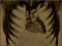 An illustration from X-ray manual : U.S. Army (1917)