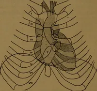 An illustration from X-ray manual : U.S. Army (1917)