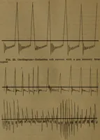 An illustration from X-ray manual : U.S. Army (1917)