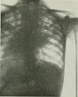 An illustration from X-rays, how to produce and interpret them (1915)