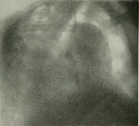 An illustration from X-rays, how to produce and interpret them (1915)