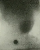 An illustration from X-rays, how to produce and interpret them (1915)