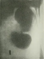 An illustration from X-rays, how to produce and interpret them (1915)