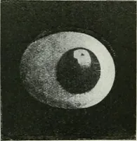 An illustration from X-rays, how to produce and interpret them (1915)