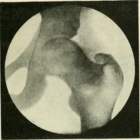 An illustration from X rays, an introduction to the study of Röntgen rays (1914)
