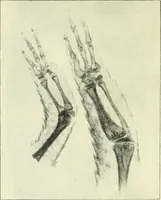 An illustration from X rays, an introduction to the study of Röntgen rays (1914)