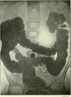 An illustration from X rays, an introduction to the study of Röntgen rays (1914)