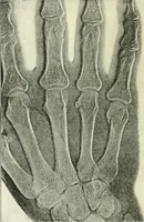 An illustration from X rays, an introduction to the study of Röntgen rays (1914)