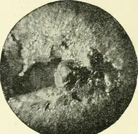 An illustration from X rays, an introduction to the study of Röntgen rays (1914)