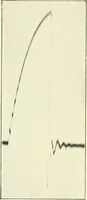 An illustration from X rays, an introduction to the study of Röntgen rays (1914)