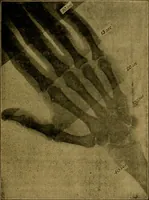 An illustration from X-rays simply explained : a handbook on the theory and practice of radiography (1903)