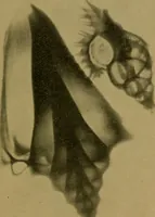 An illustration from X-rays simply explained : a handbook on Röntgen rays in theory and practice (1904)