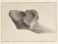 An illustration from Zur anthropologie des abflusslosen rumpfschollenlandes im nordöstlichen Deutsch-Ostrafrika, auf grund der sammlung der Ostrafrika- expedition (dr. E. Obst) der Geographischen gesellschaft in Hamburg (1915)