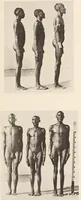 An illustration from Zur anthropologie des abflusslosen rumpfschollenlandes im nordöstlichen Deutsch-Ostrafrika, auf grund der sammlung der Ostrafrika- expedition (dr. E. Obst) der Geographischen gesellschaft in Hamburg (1915)
