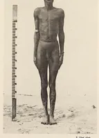 An illustration from Zur anthropologie des abflusslosen rumpfschollenlandes im nordöstlichen Deutsch-Ostrafrika, auf grund der sammlung der Ostrafrika- expedition (dr. E. Obst) der Geographischen gesellschaft in Hamburg (1915)