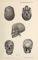 Picture 4 of 17 from Zur anthropologie des abflusslosen rumpfschollenlandes im nordöstlichen Deutsch-Ostrafrika, auf grund der sammlung der Ostrafrika- expedition (dr. E. Obst) der Geographischen gesellschaft in Hamburg (1915), leaf 61