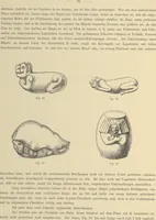 Picture 1 of 41 from Alt-Mexico : Archäologische Beiträge zur Kulturgeschichte seiner Bewohner : [volume 2] / von Hermann Strebel (1885), leaf 64