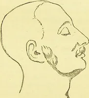 An illustration from The criminal / by Havelock Ellis. (1895)