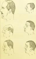 An illustration from The criminal / by Havelock Ellis. (1895)