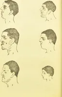 An illustration from The criminal / by Havelock Ellis. (1895)