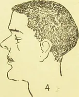 An illustration from The criminal / by Havelock Ellis. (1895)