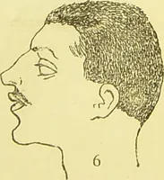 An illustration from The criminal / by Havelock Ellis. (1895)