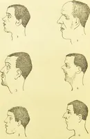 An illustration from The criminal / by Havelock Ellis. (1895)