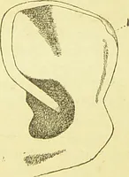 An illustration from The criminal / by Havelock Ellis. (1895)