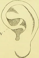 Picture 5 of 13 from The criminal / by Havelock Ellis. (1895), leaf 87