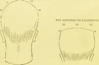 An illustration from Elements of phrenology / by George Combe. (1873)