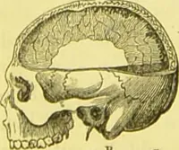 An illustration from Elements of phrenology / by George Combe. (1873)