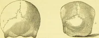 An illustration from Elements of phrenology / by George Combe. (1873)
