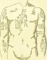 Picture 9 of 12 from The criminal / by Havelock Ellis. (1890), leaf 115