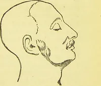 An illustration from The criminal / by Havelock Ellis. (1890)