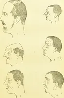 An illustration from The criminal / by Havelock Ellis. (1890)