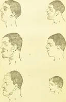 An illustration from The criminal / by Havelock Ellis. (1890)