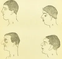 An illustration from The criminal / by Havelock Ellis. (1890)