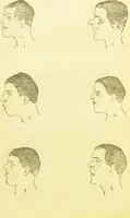 An illustration from The criminal / by Havelock Ellis. (1890)