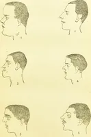 An illustration from The criminal / by Havelock Ellis. (1890)