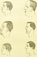 An illustration from The criminal / by Havelock Ellis. (1890)