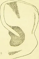 An illustration from The criminal / by Havelock Ellis. (1890)