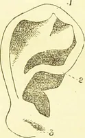 An illustration from The criminal / by Havelock Ellis. (1890)