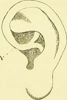 An illustration from The criminal / by Havelock Ellis. (1890)